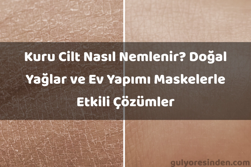 kuru cilt nasıl nemlenir