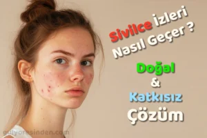 sivilce izleri nasıl geçer